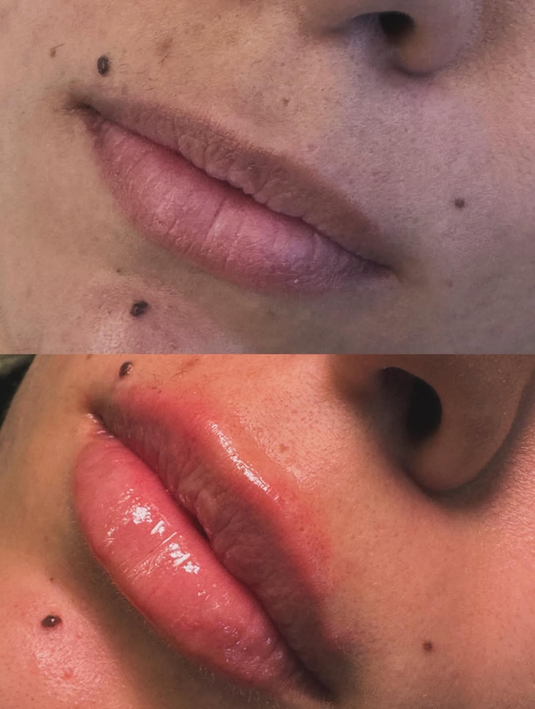 Antes e depois — resultado 1